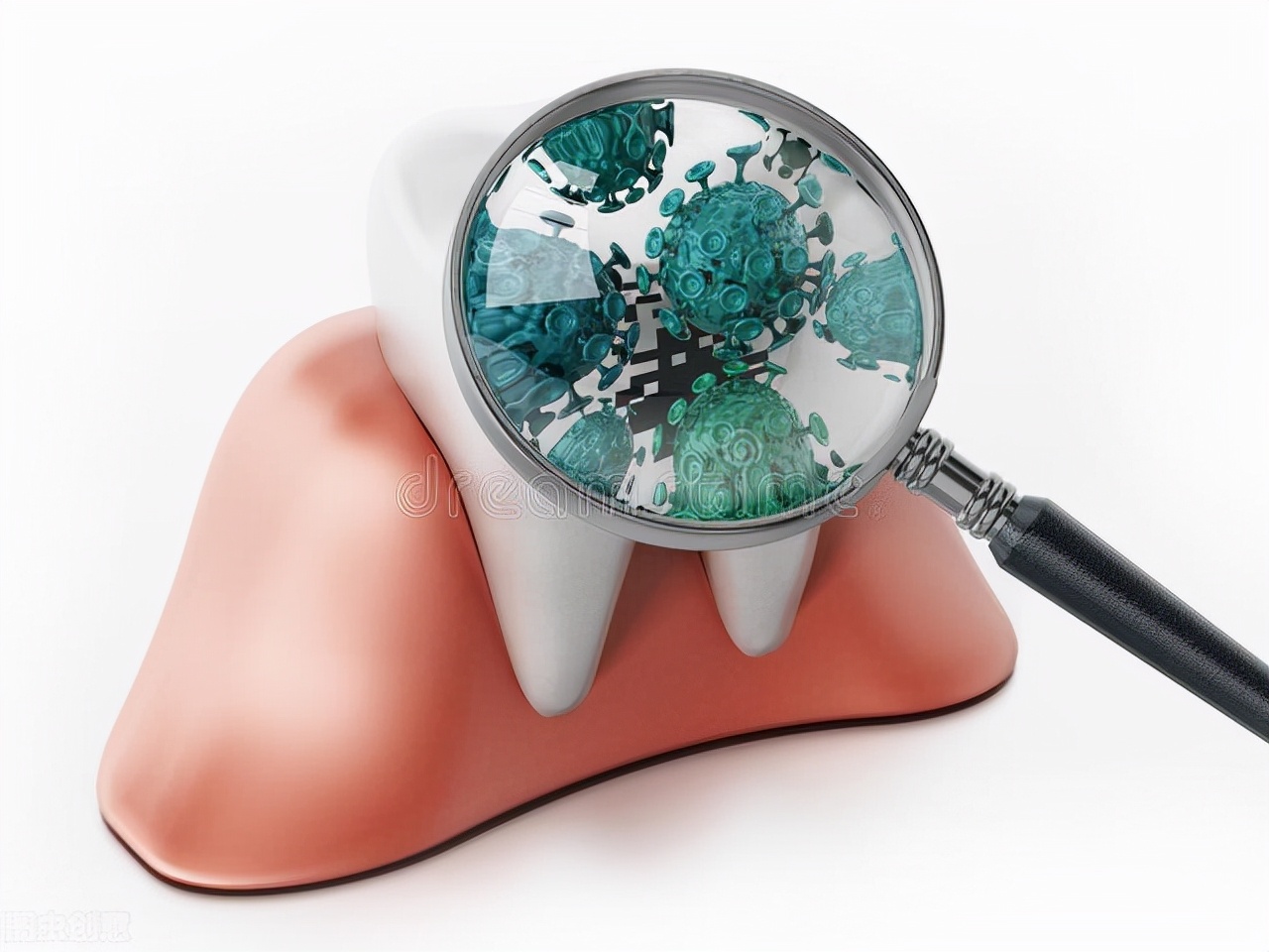 修复缺牙的最好方法,告别“老掉牙”看清这些招