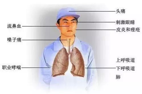 焊接职业危害主要有哪几类,焊接车间存在的职业危害有哪些