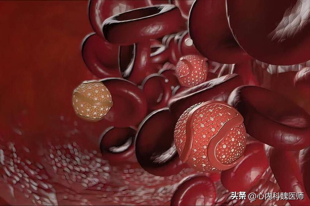 脂蛋白a升高有什么危险,高密度脂蛋白偏低和脂蛋白a偏高