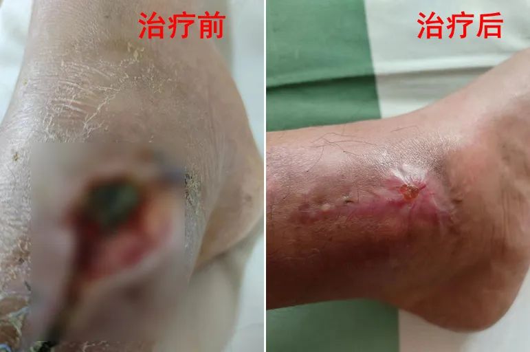 治疗神器排名,治疗疾病最好的良药