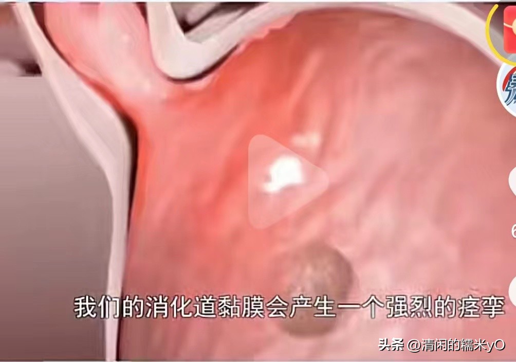 男子一口闷冰镇红茶后狂吐,男子喝冰红茶狂吐1000