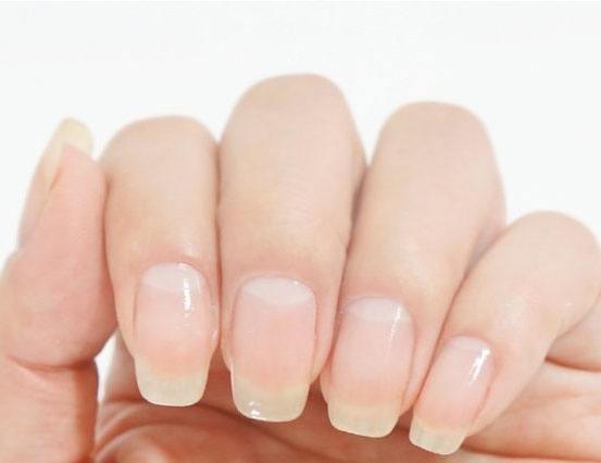 手指甲为什么会出现问题,手指甲和脚指甲有竖纹怎么回事