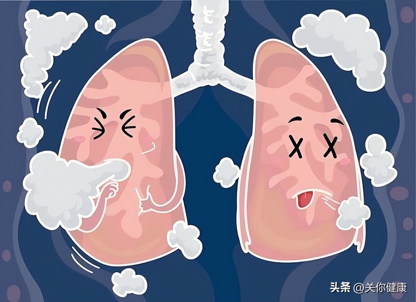 观察痰液,咳嗽咳痰的观察