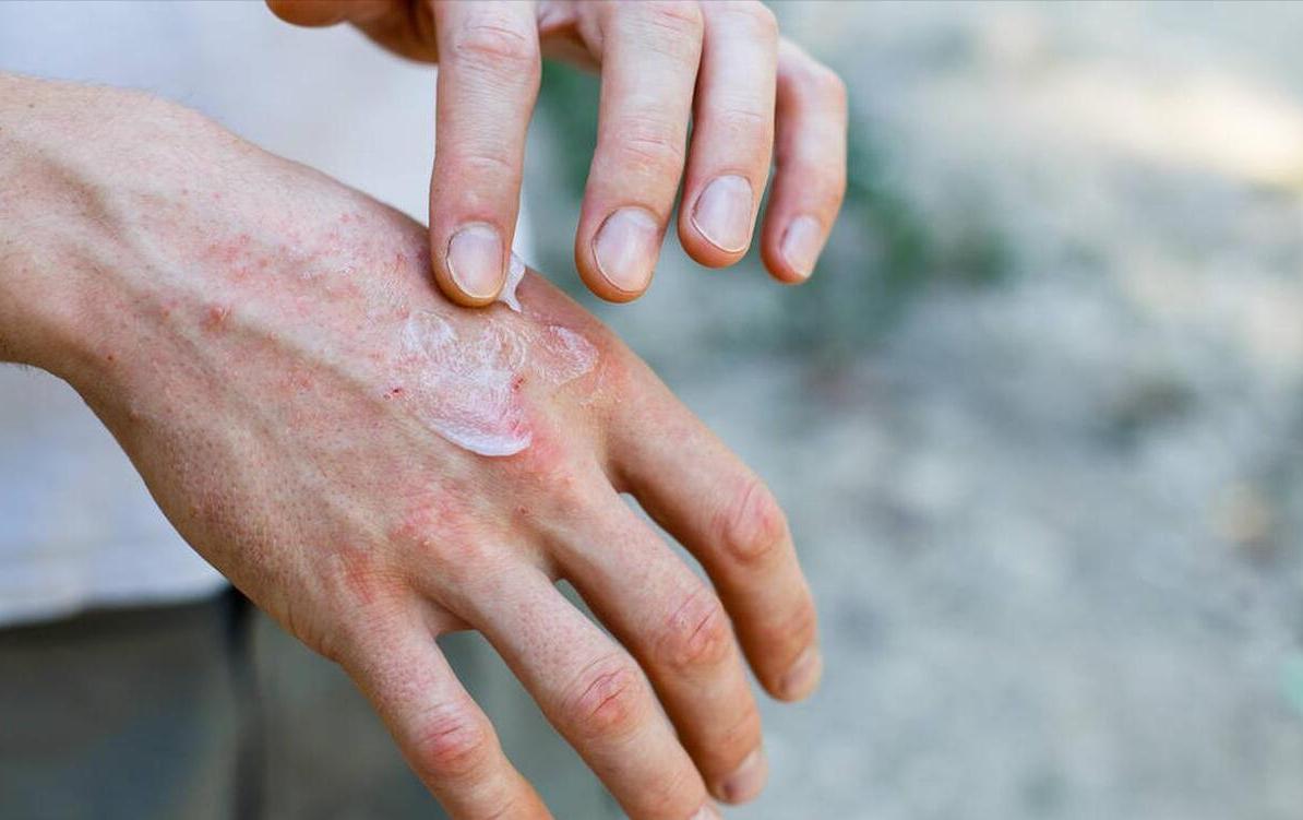 正常人误吃降压药三年了有危险吗,吃了5年的降压药怎么合理停了