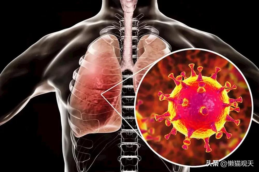 新冠一阳没阳二阳会怎么样,新冠二阳后老是干咳吃什么药管用