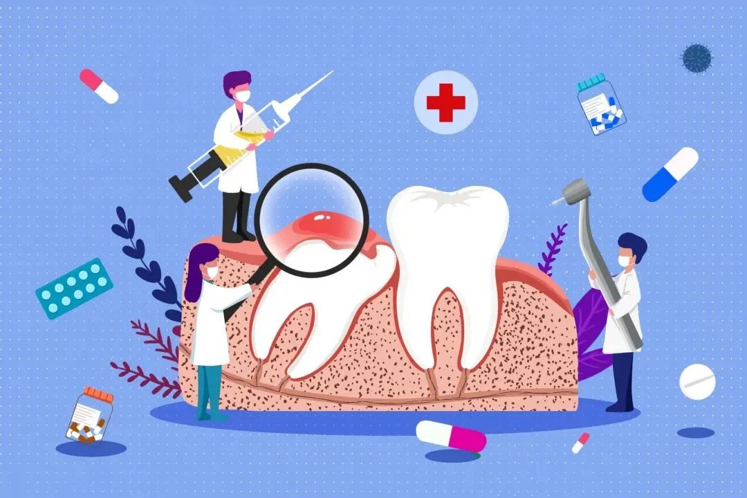 智齿不痛但是不舒服,智齿到底要不要拔医生告诉你答案