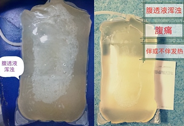 健康科普夏季知识宣传内容,夏日健康全科普