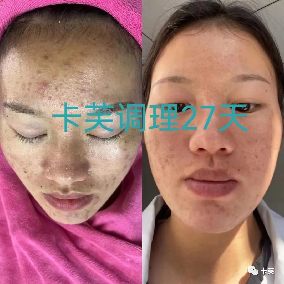 地龙多肽多效美肤霜，赋予你应有的健康、美丽与自信