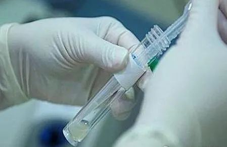 试管婴儿常识100例,试管精子是怎么优化处理的