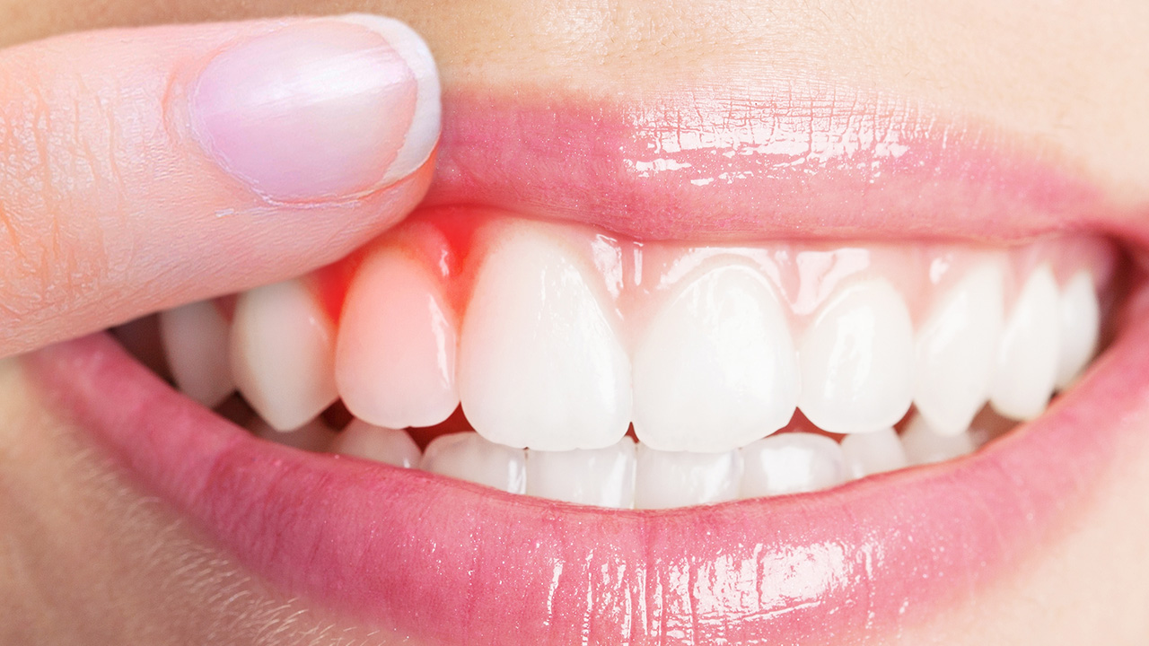 心肝脾肺肾都上火如何去火,上火的症状和清火的方法