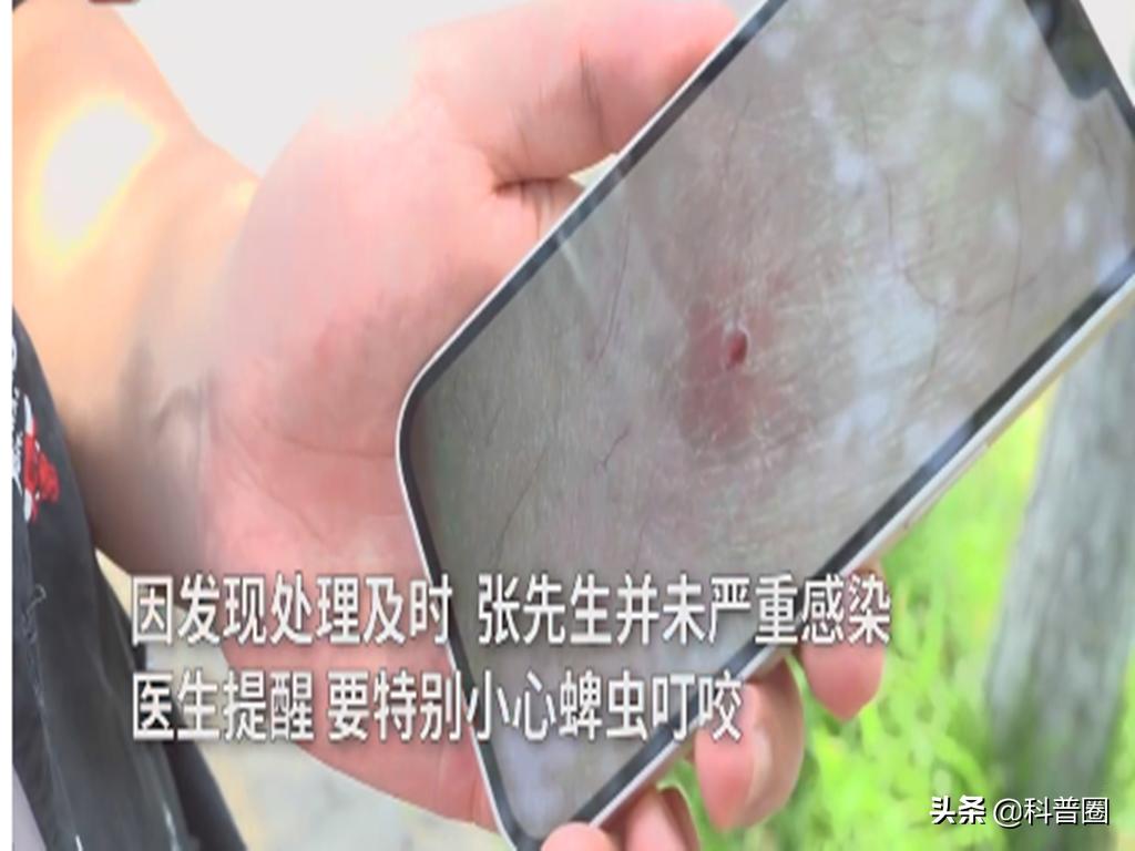 致命蜱虫,比蜱虫还可怕