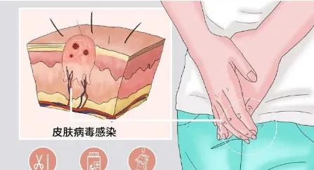 尖锐性湿疣的hpv病毒可以治愈吗,尖锐性湿疣hpv一定是阳性吗