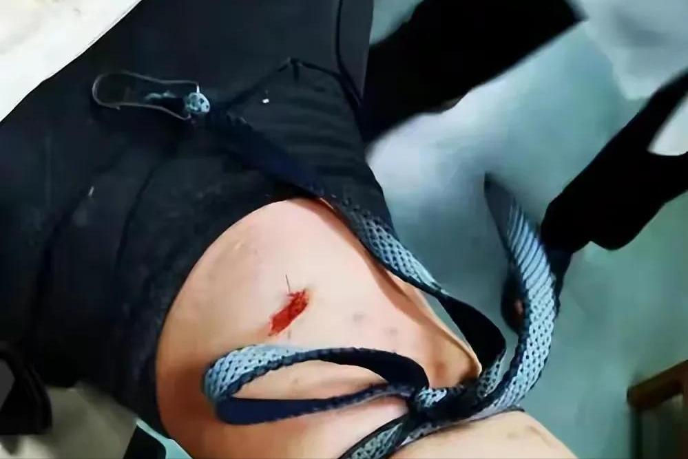 毒蛇出没之处必有解药,毒蛇出没七步之内真有解药吗