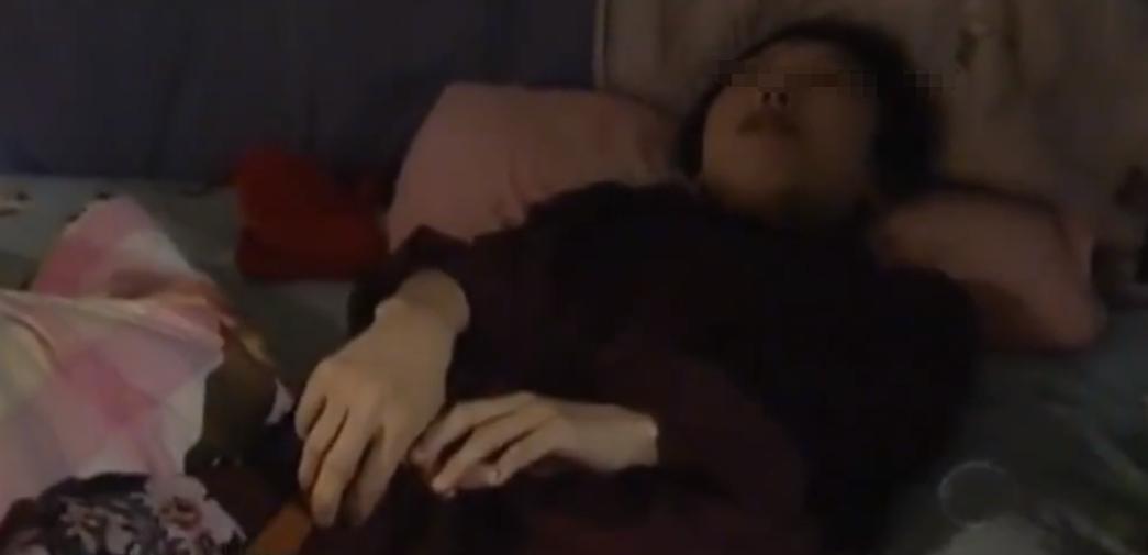 故事：大连39岁姑娘患怪病，皮肤坚硬宛如石膏，专家结论希望渺茫