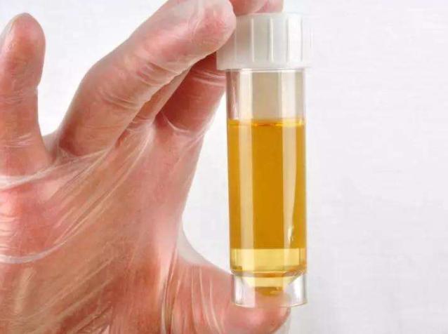 内裤黄分泌物是什么,裤底有黄色分泌物