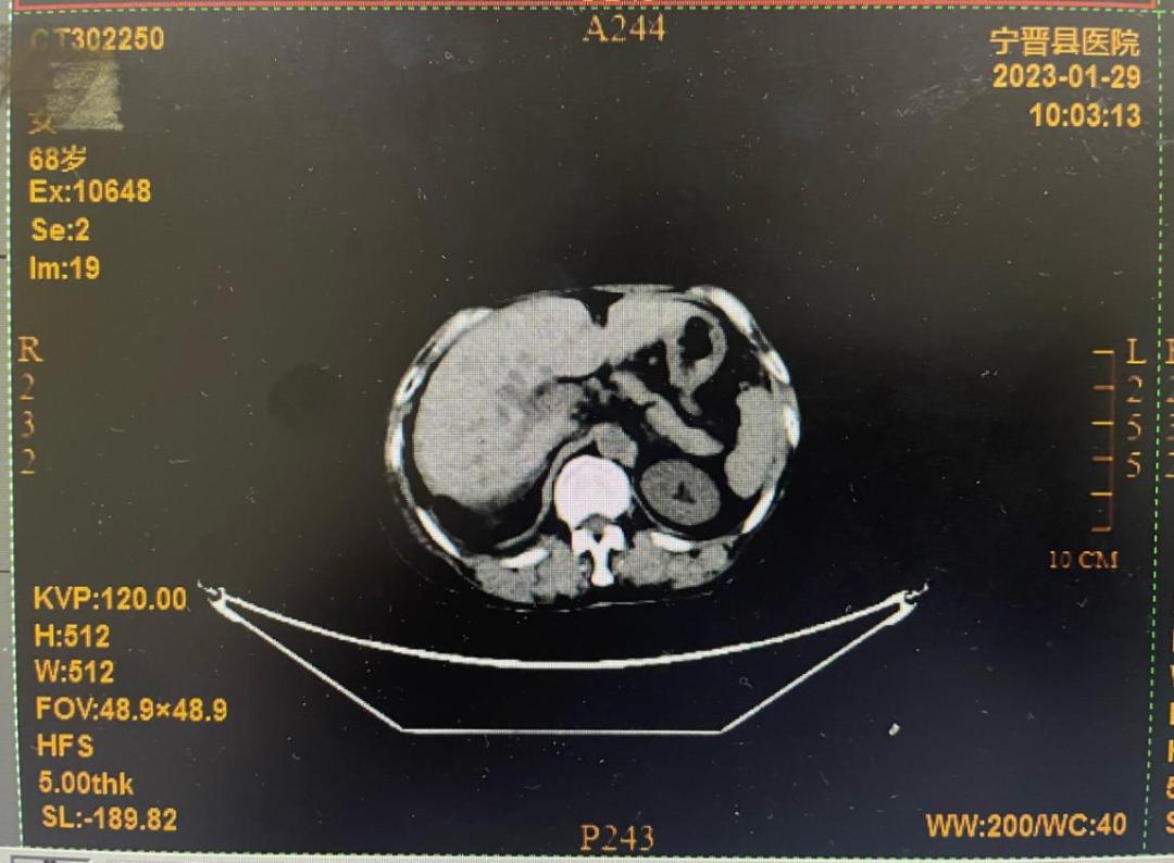 肿瘤君催泪片段,肿瘤君主题曲