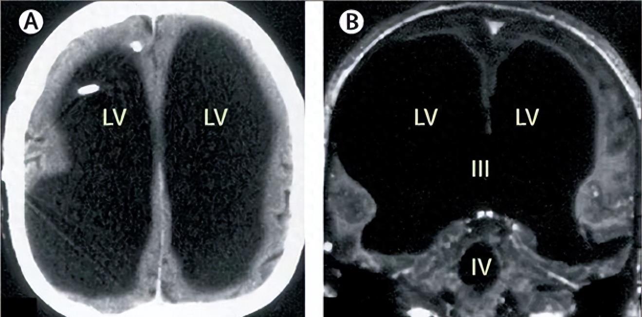 15个活久见的事实：阴道里长了“牙齿”，14世纪的“乳房袋”