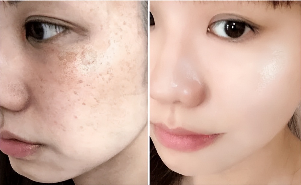 国产美白祛斑护肤品哪个牌子好,哪种护肤品美白淡斑效果好用呢