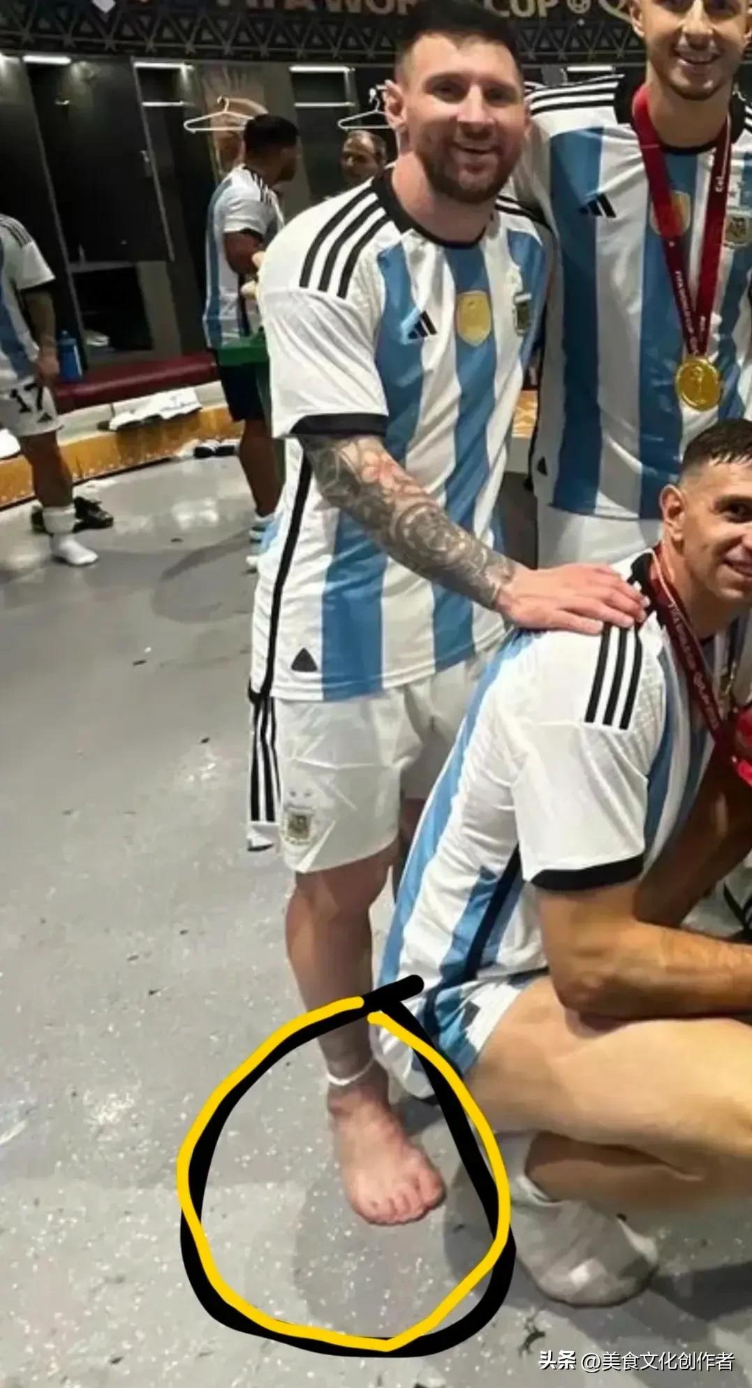 世界杯运动员脚趾甲,世界杯运动员的脚