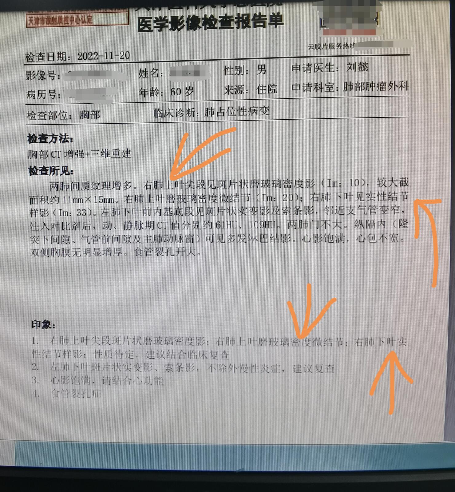 刘懿博士说肺癌化疗,刘懿博士说肺癌的书