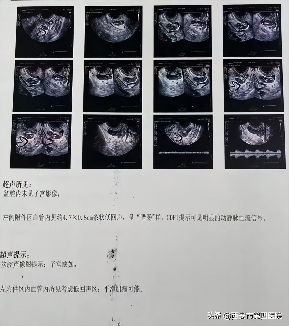 鍏ㄦ皯鍋ュ悍绱犲吇鎻愬崌璁″垝,鍏ㄦ皯鍋ュ悍姘村钩鎻愬崌琛屽姩璧勬枡