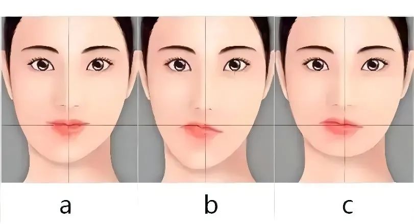 韦敏做下颌角怎么样,韦敏唇裂修复
