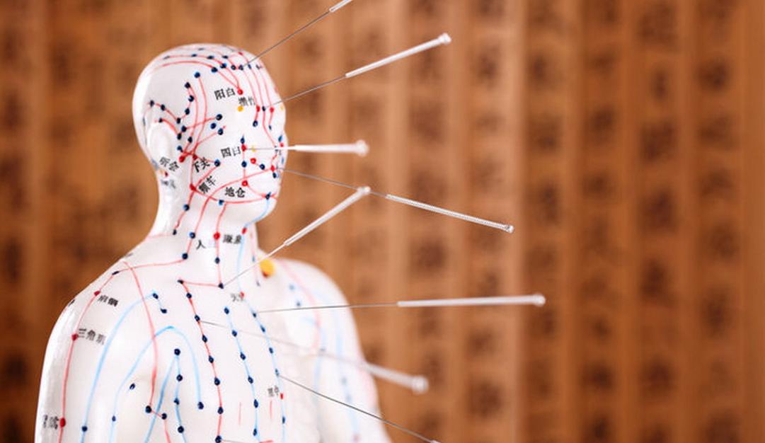 日本针灸铜人,日本古代铜人针灸