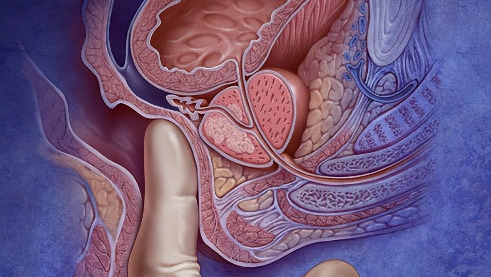 直肠癌的4个身体暗示需要警惕,直肠癌多半是拖出来的