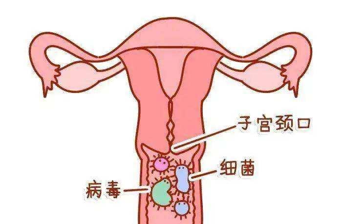 为什么月经过后有褐色分泌物,为什么月经过后还有褐色分泌物