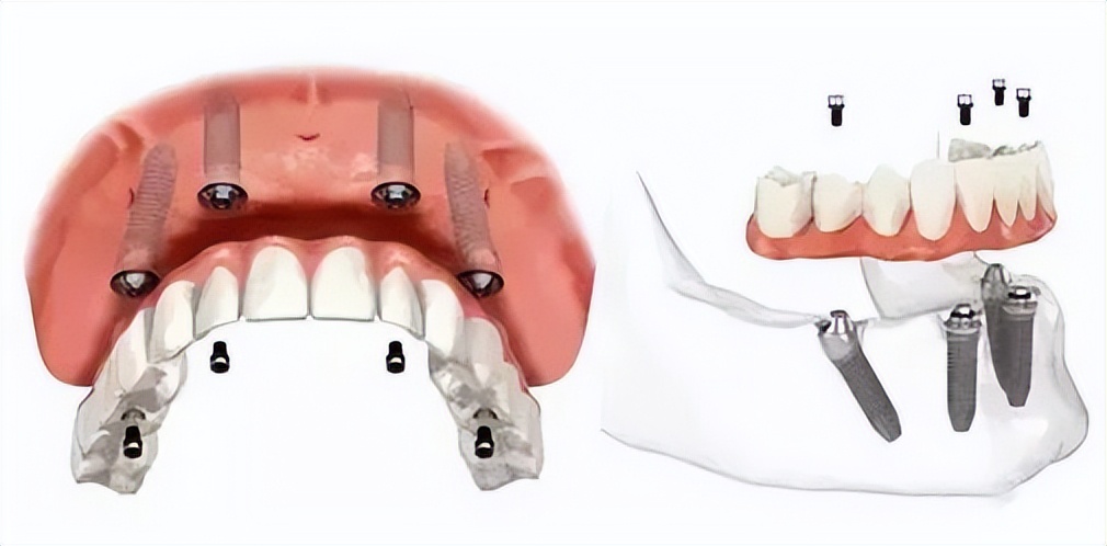 MaloClinic集团处于破产边缘，创始人保罗·马泷负债千万