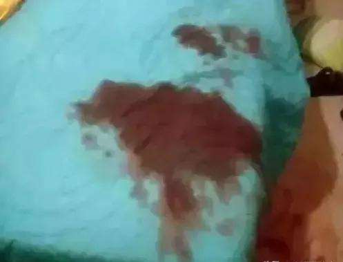 用剪刀切掉生殖器判几年,男子生殖器被剪违法不