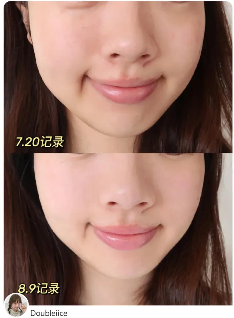 夏季应该怎么美白,夏季如何做好美白