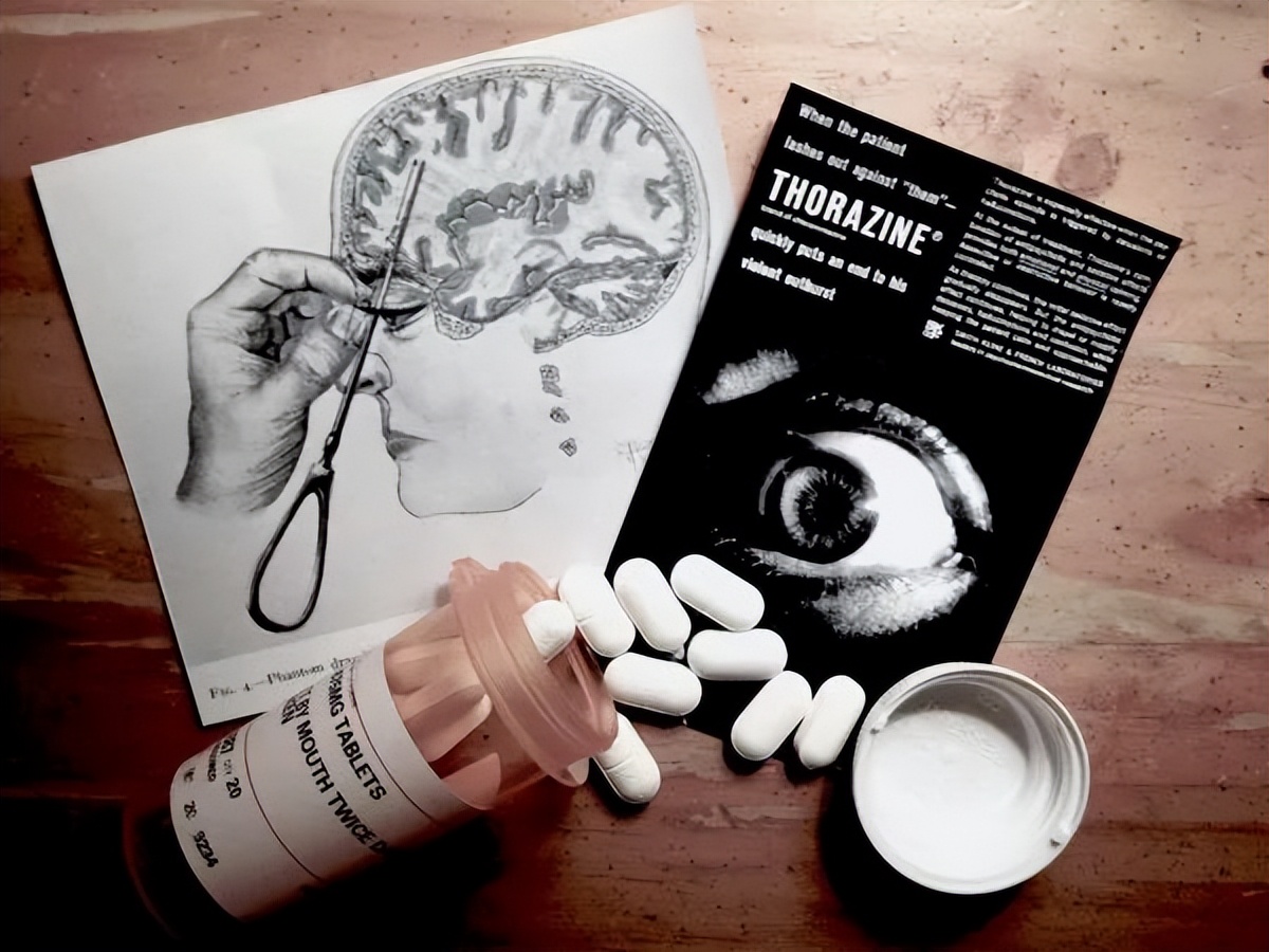 诺贝尔奖前额叶切除术,诺贝尔奖历史完整版