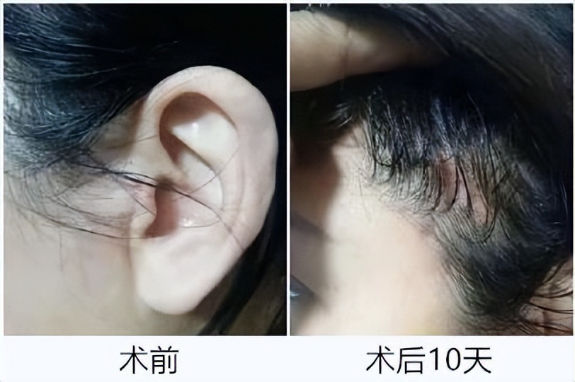 八大处医院杨喆抖音,八大处整形医院杨喆