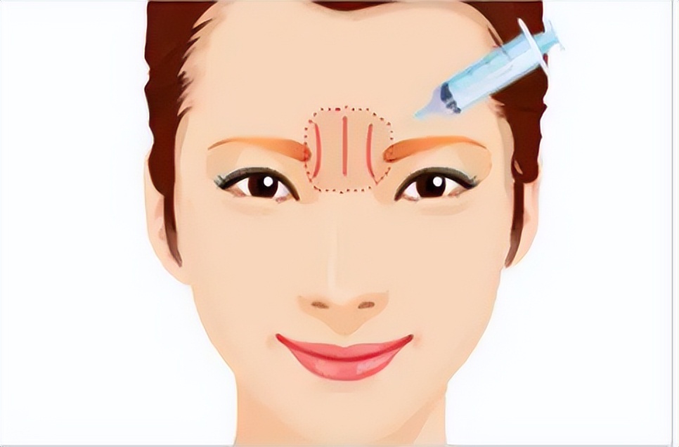 美短川字纹和英短川字纹的区别,左手川字纹和右手川字纹会怎样