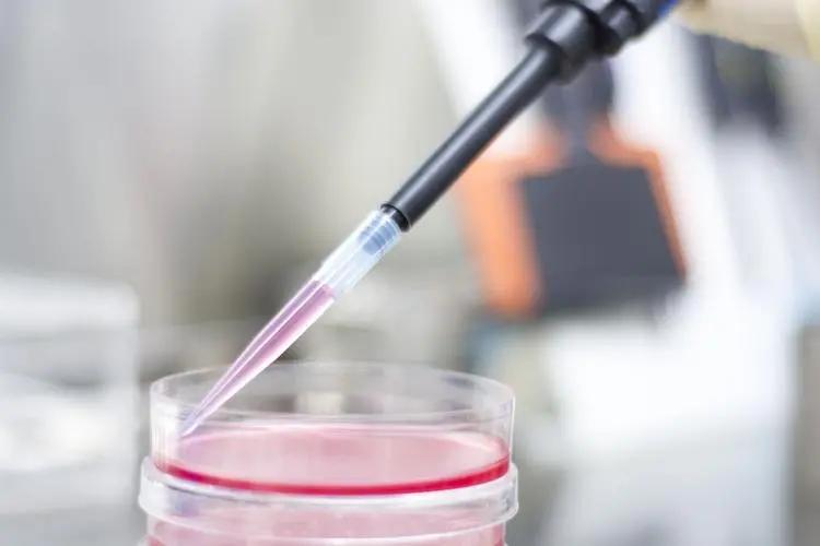 发酵液的提取常用方法,发酵液提取分离的主要方法