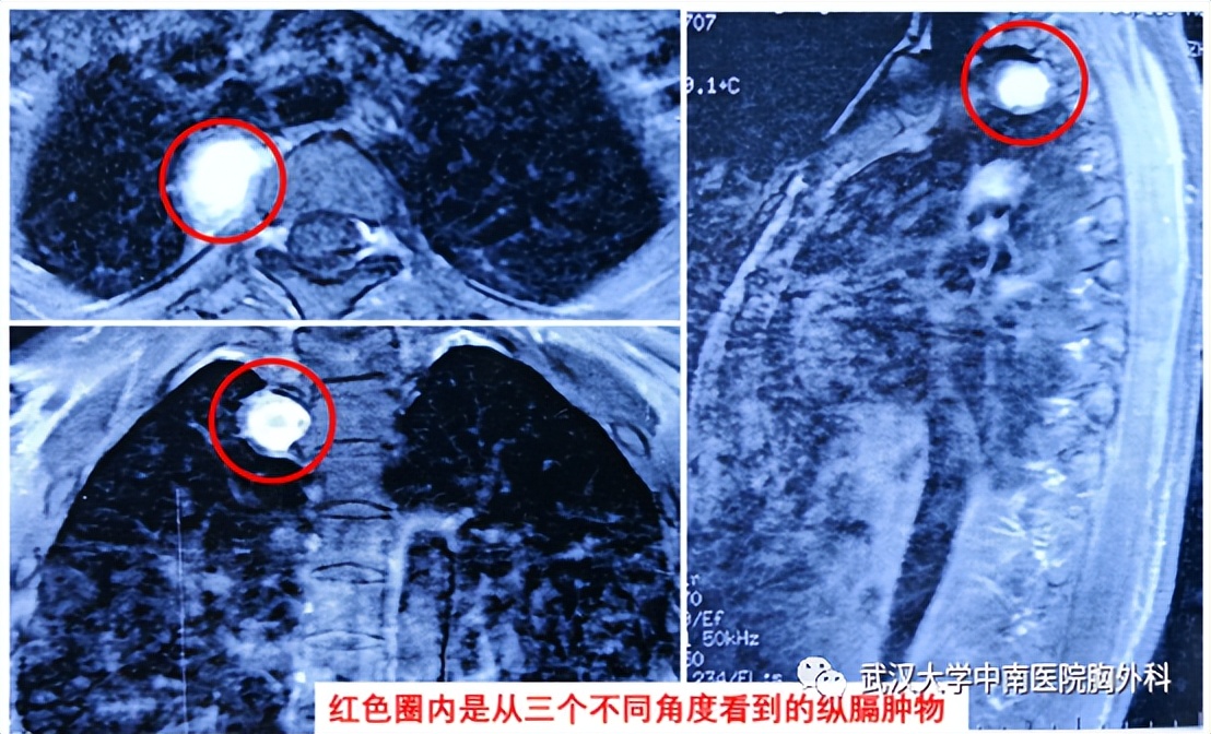 日间手术|患者从入院到出院只需一天！你了解日间手术吗？