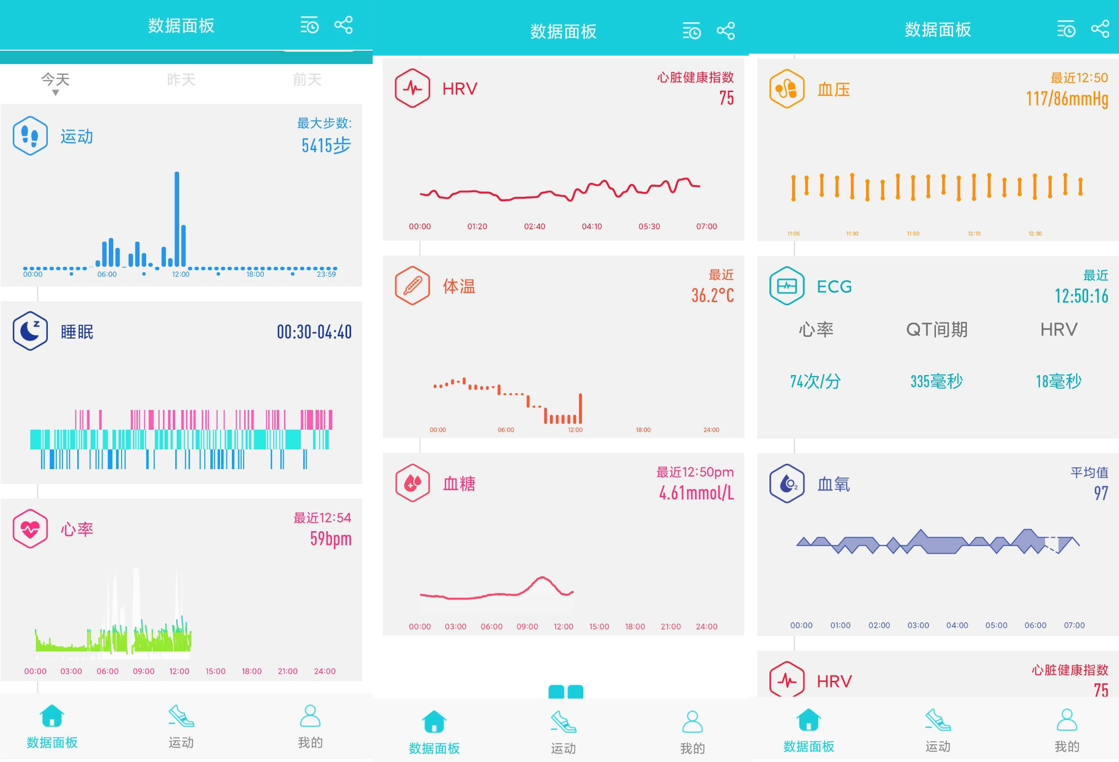 didoe55spro智能手表功能,didoe55promax智能手表评测
