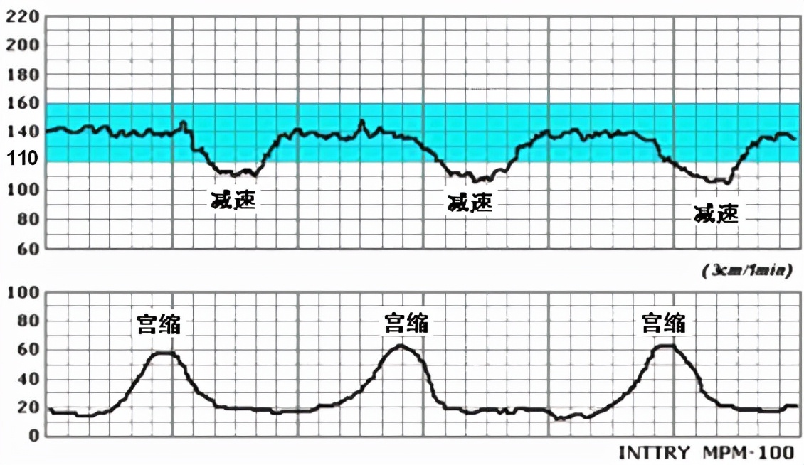 孕妈妈需要经历什么,从怀孕到生需要做多少次产检