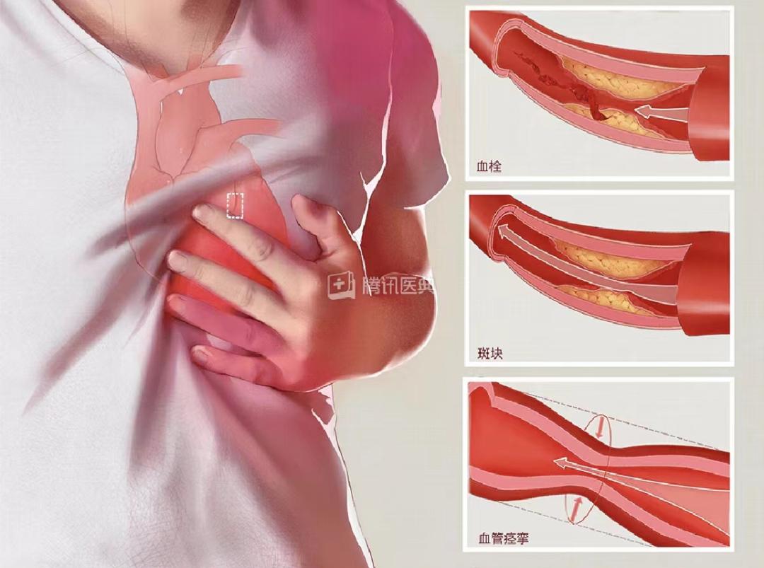 被气出来的6种疾病每一种都要命,这些病都是被气出来的看看这4点