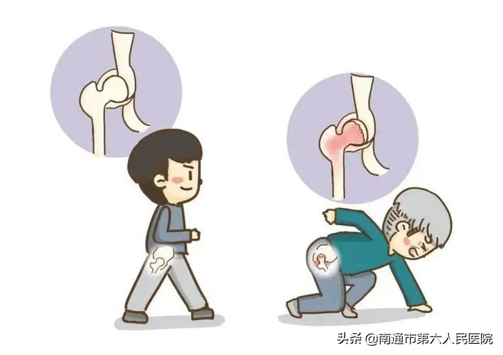 96岁老人意外骨折最终结果,96岁高龄老人骨折手术成功