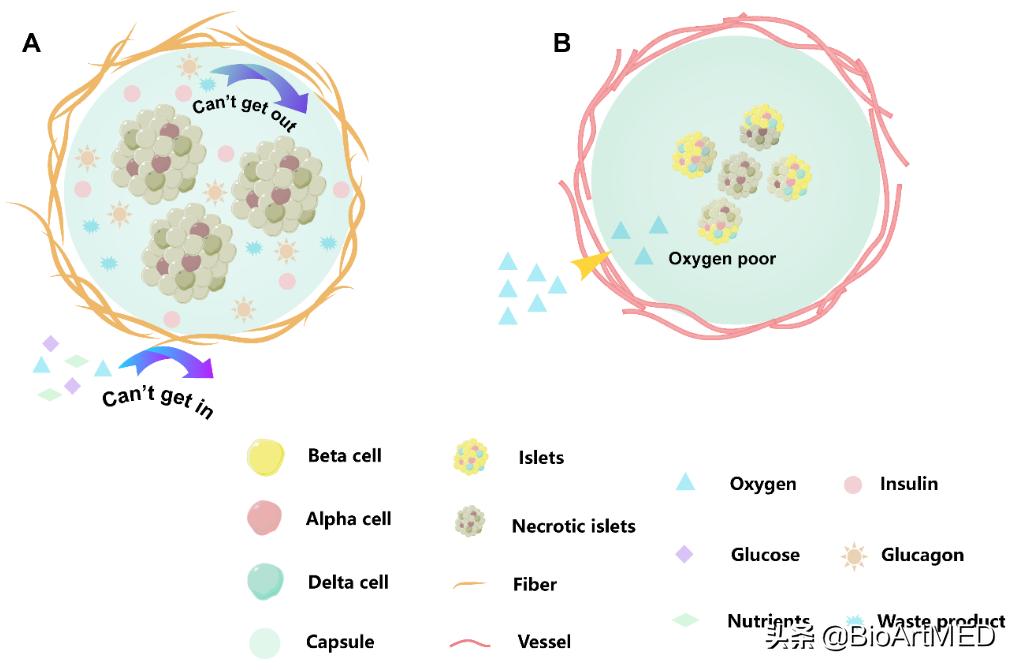 胰岛移植治疗1型糖尿病的前景,糖尿病胰岛细胞再生修复治疗