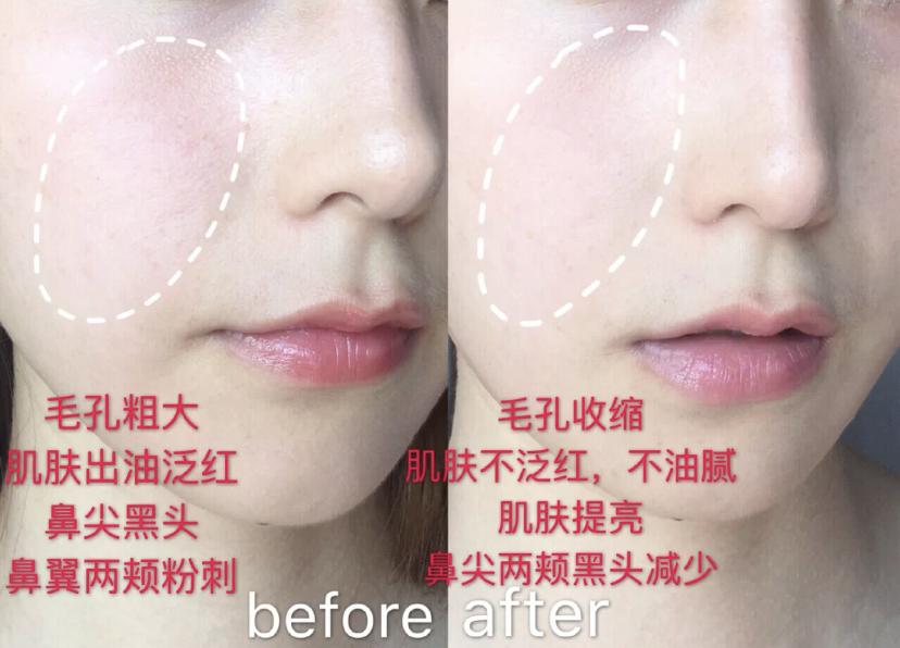 科颜氏白泥面膜清洁去黑头125ml,科颜氏白泥面膜真的能去黑头吗