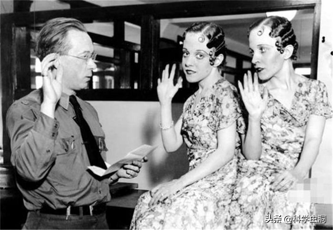 连体姐妹其中一个人死了怎么办,连体姐妹一个死了另一个咋办