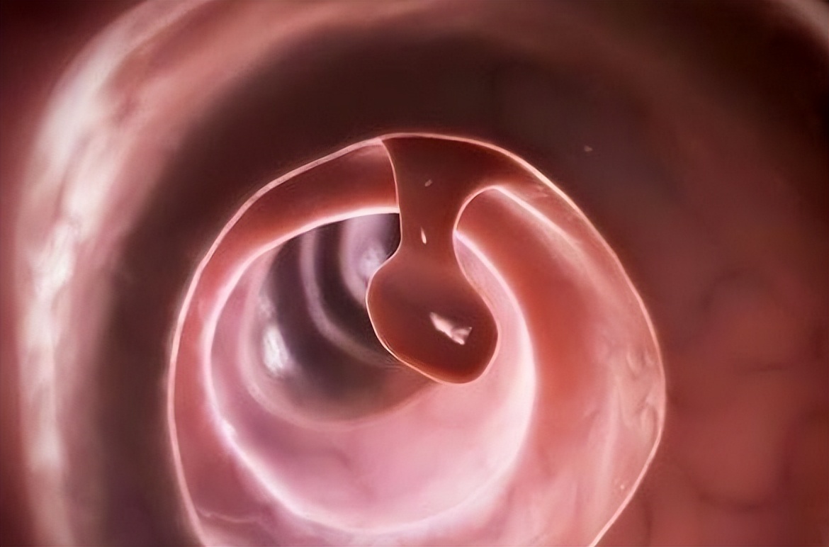 “普通胃镜”与“无痛胃镜”，二者有什么不同？医生告诉你答案