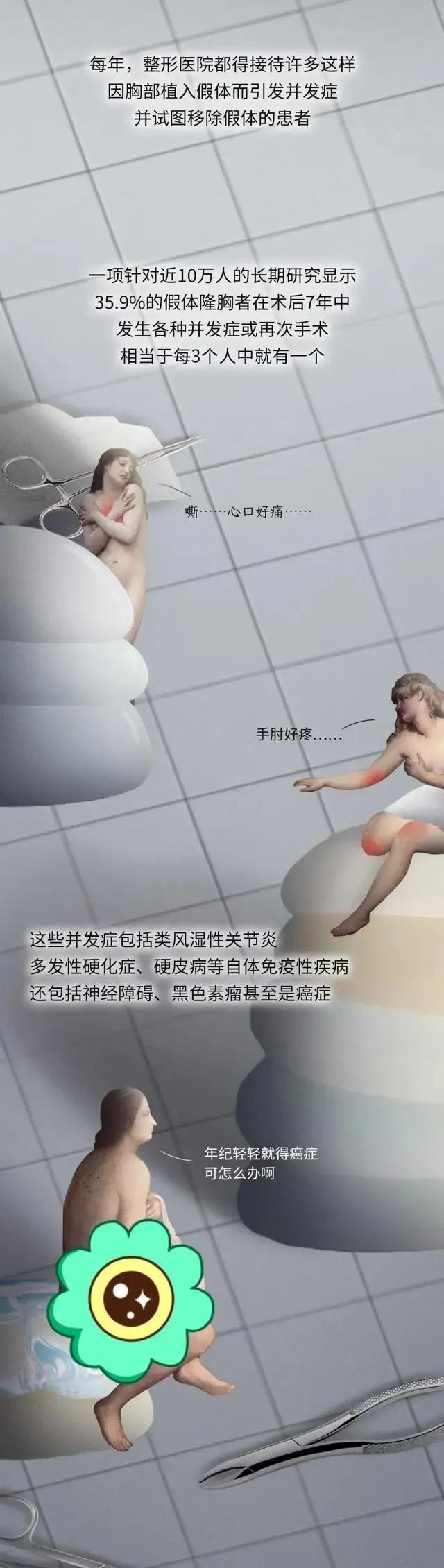第一个隆胸的女人,全球最红隆胸女人