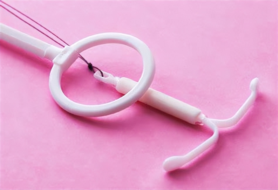 以前上环的女性30多年后现状如何,我国第一批上环的女性现在怎么样