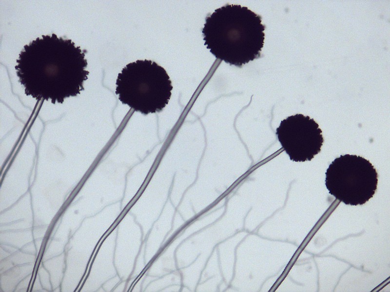 喝普洱茶等于自杀？一克普洱熟茶含五亿霉菌，普洱茶到底能不能喝