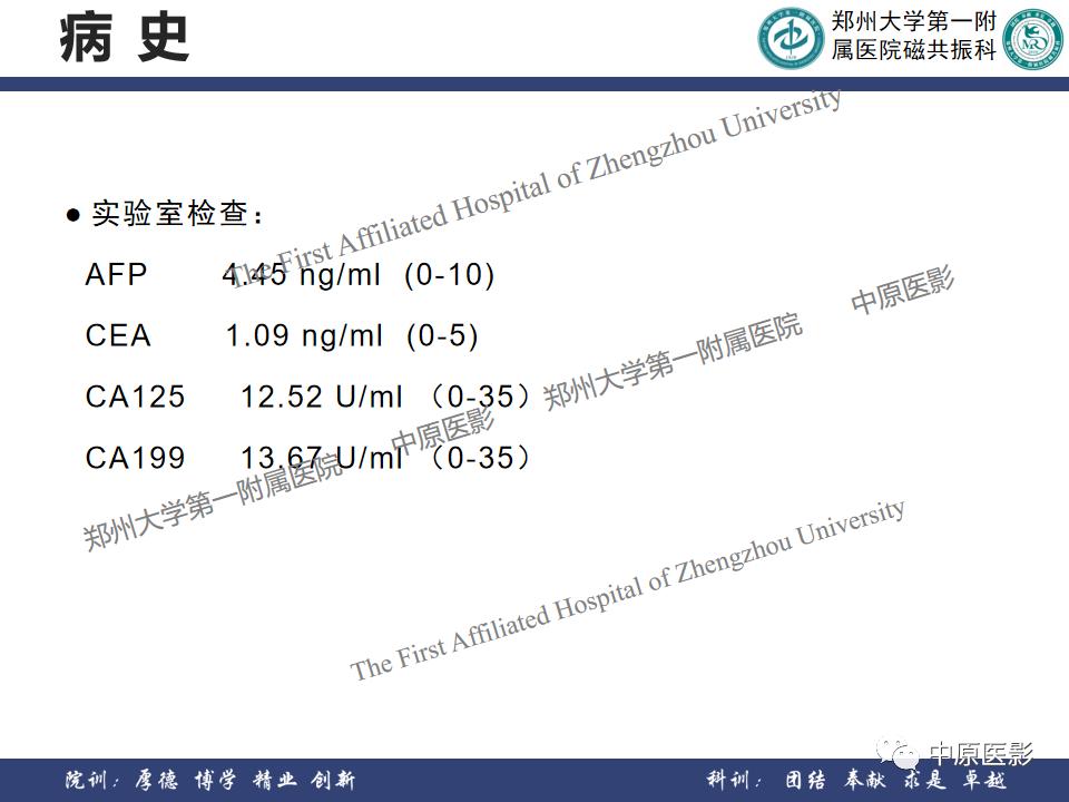 肝脏血管瘤样本,正确认识肝脏血管瘤文章
