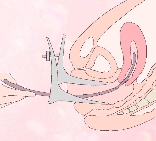 “正经女生哪会得妇科病？”快闭嘴吧你